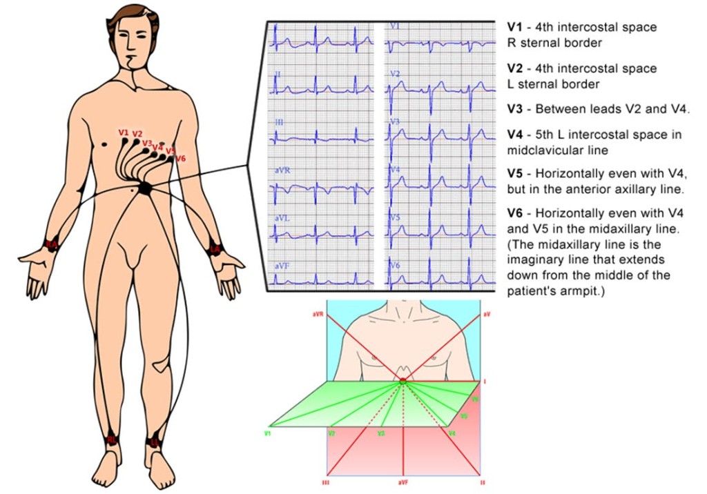 NYC Cardiologist Best Cardiologist in NYC